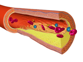 Is Cholesterol Lowering Medicine ( statins ) Bad for You?