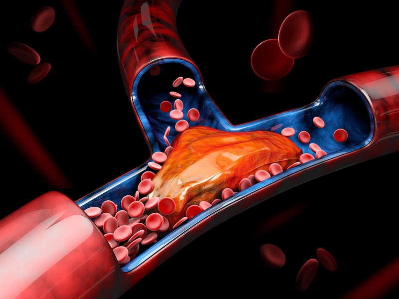 Increased blood clotting in African Americans